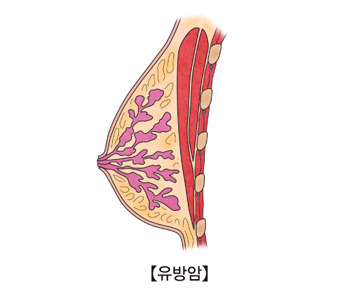 유방 이미지